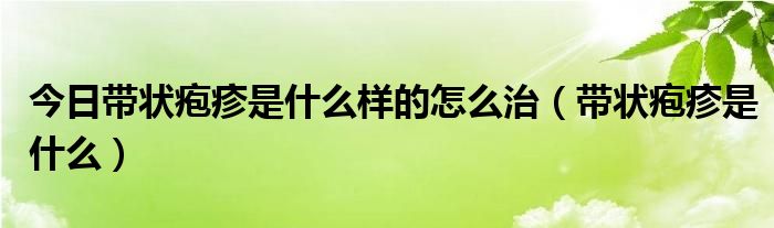 今日带状疱疹是什么样的怎么治（带状疱疹是什么）