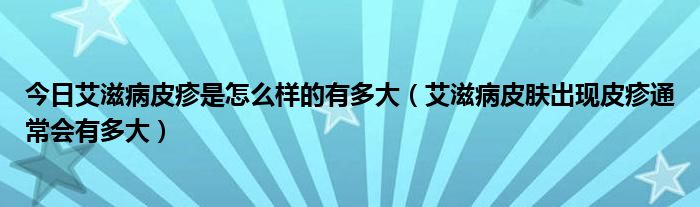 今日艾滋病皮疹是怎么样的有多大（艾滋病皮肤出现皮疹通常会有多大）