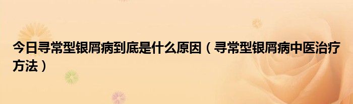 今日寻常型银屑病到底是什么原因（寻常型银屑病中医治疗方法）