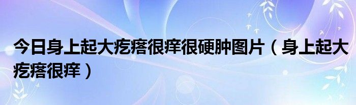 今日身上起大疙瘩很痒很硬肿图片（身上起大疙瘩很痒）