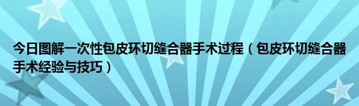 今日图解一次性包皮环切缝合器手术过程（包皮环切缝合器手术经验与技巧）